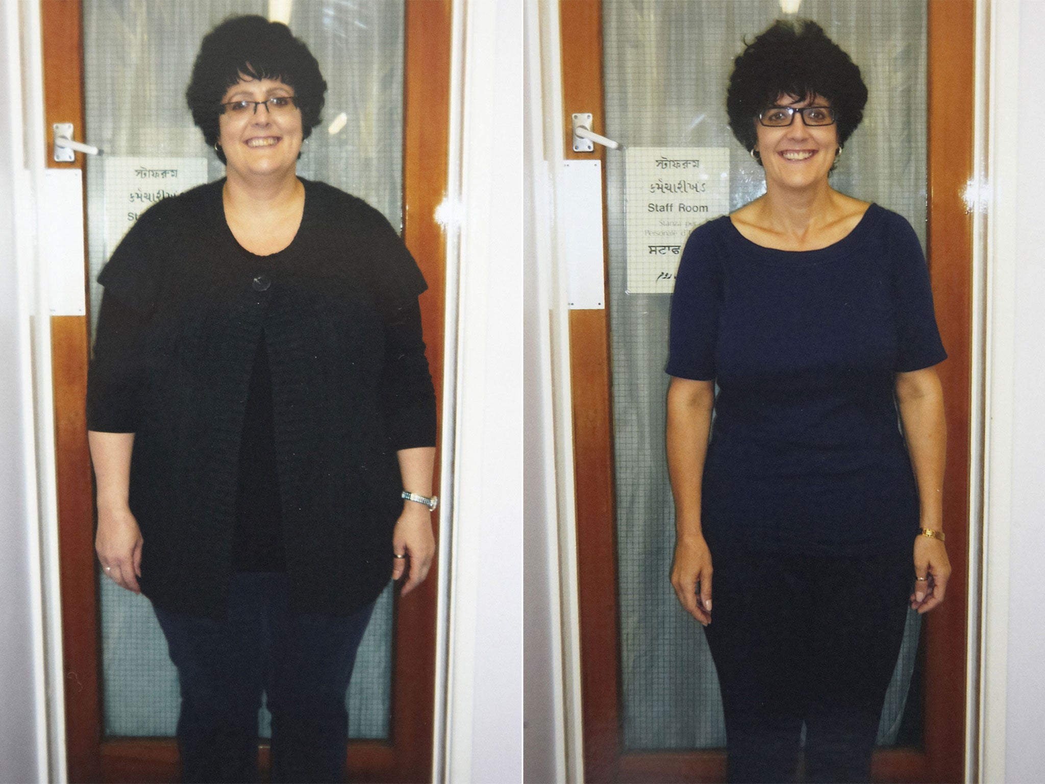 100 Gastric Sleeve Before and After pics, Weight Loss Surgery
