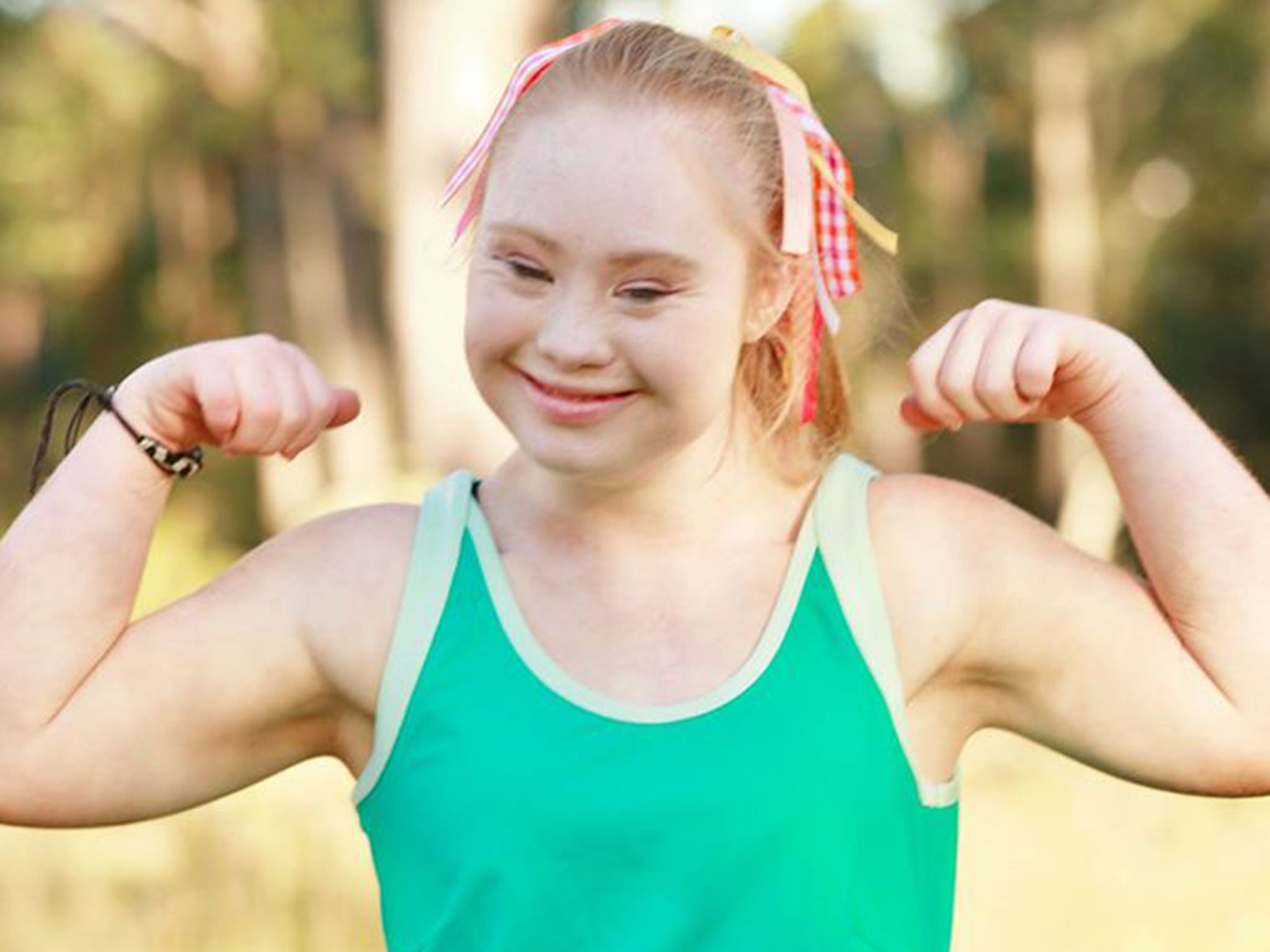 Girl with Down syndrome changing face of modeling