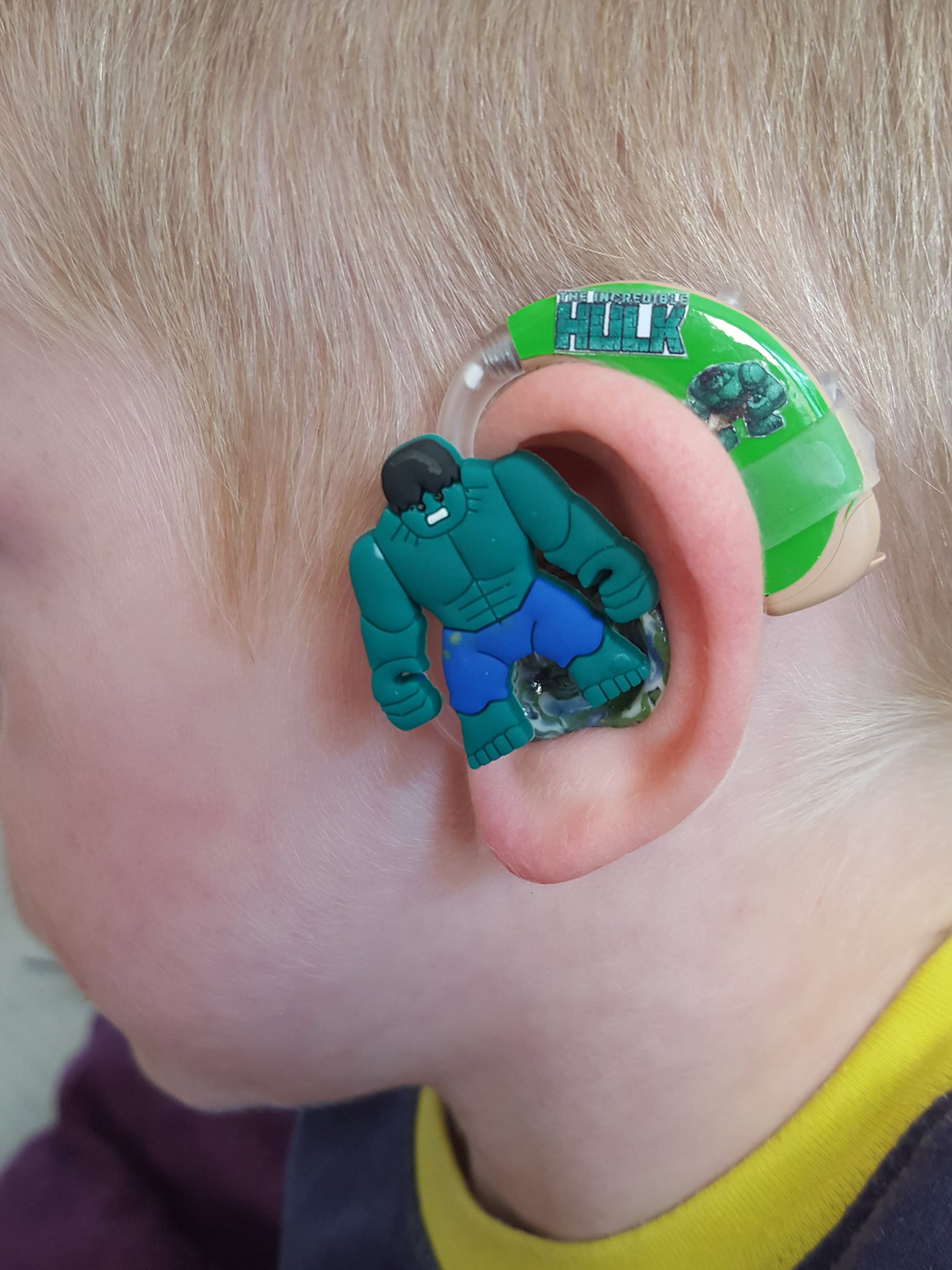 hearing aid 7