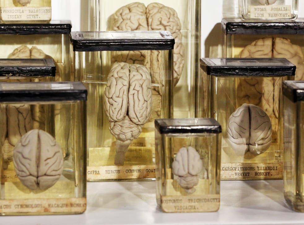 Animal brains are preserved at The Grant Museum of Zoology on September 4, 2012 in London, England