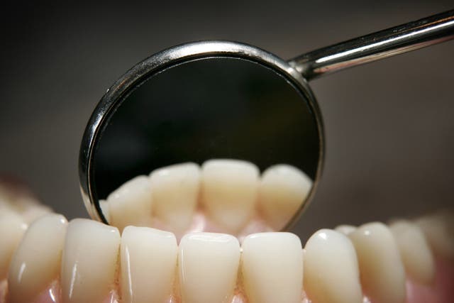 Debris between the teeth can build up and irritate gums, causing inflammation and eventually disease