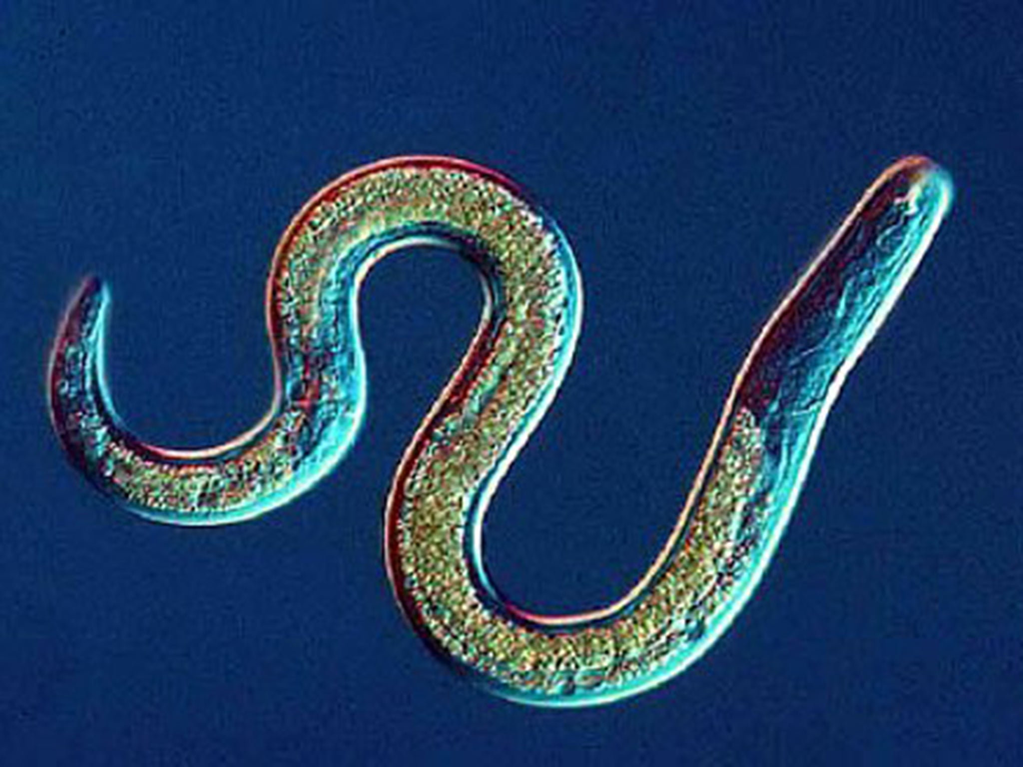 Nematode worms use slugs like taxis to ferry them around the garden