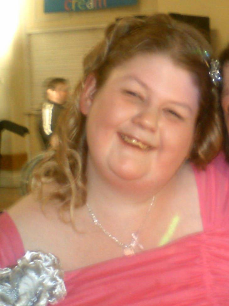 Kirsty Derry suffered from a rare syndrome that caused her to overeat