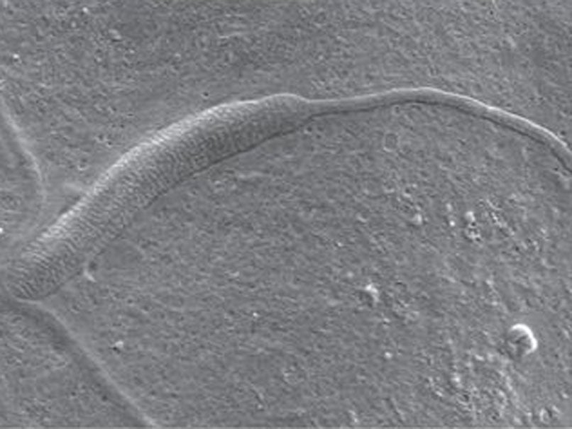 Image of the world's oldest fossilised sperm fragment showing the granular texture and tail