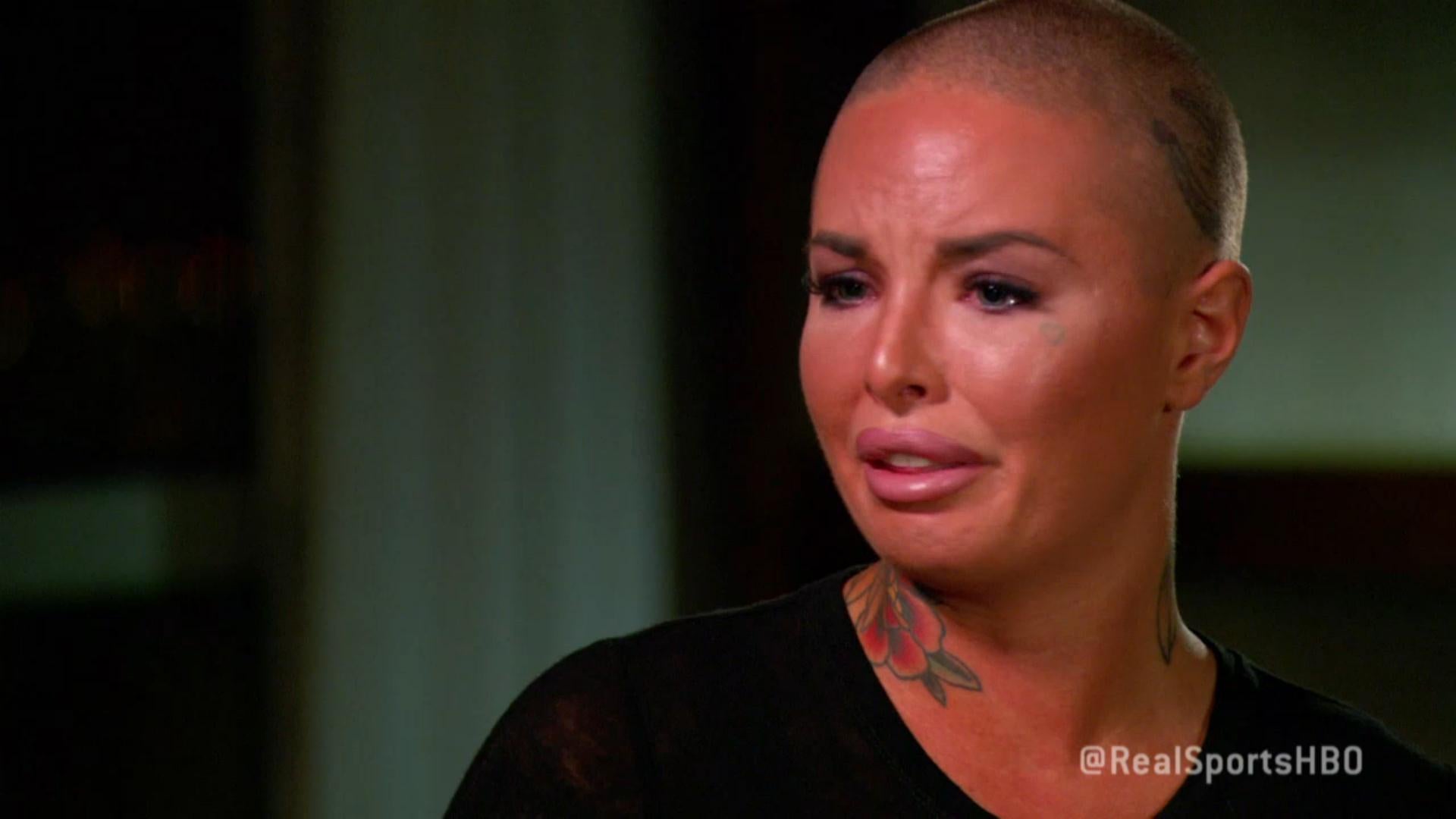 Christy Mack was hospitalised by the attack