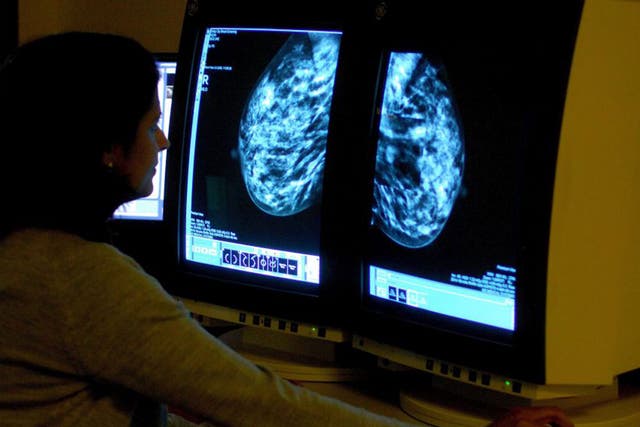 A consultant analysing a mammogram showing a woman's breast in order check for breast cancer