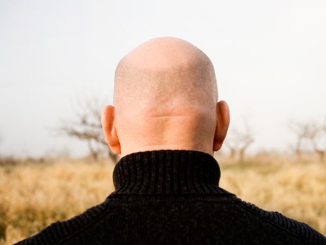 The study is believed to be the first to test the link between hair loss and common airborne pollutants such as fine dust and diesel particles