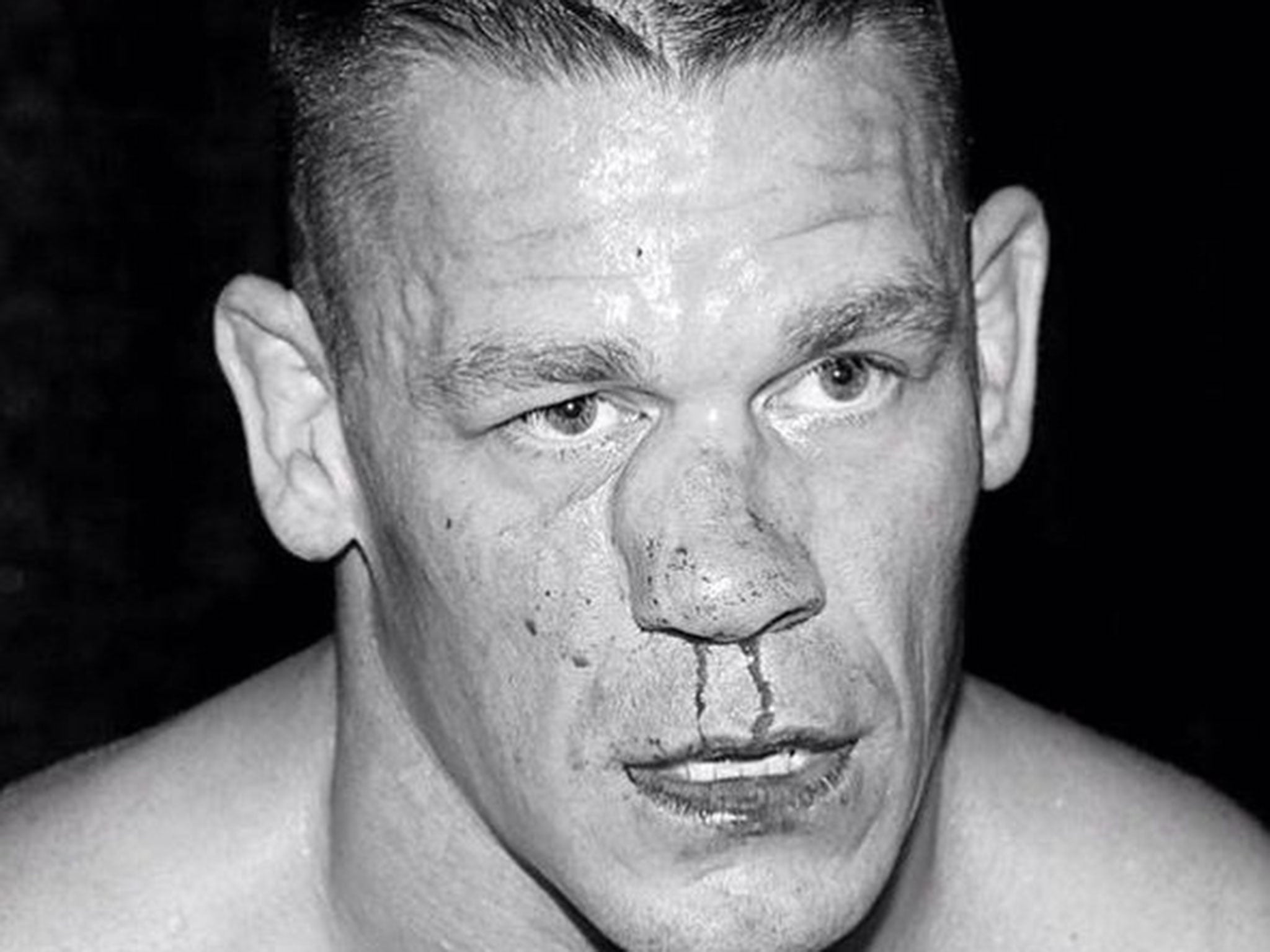 John Cena and his broken nose