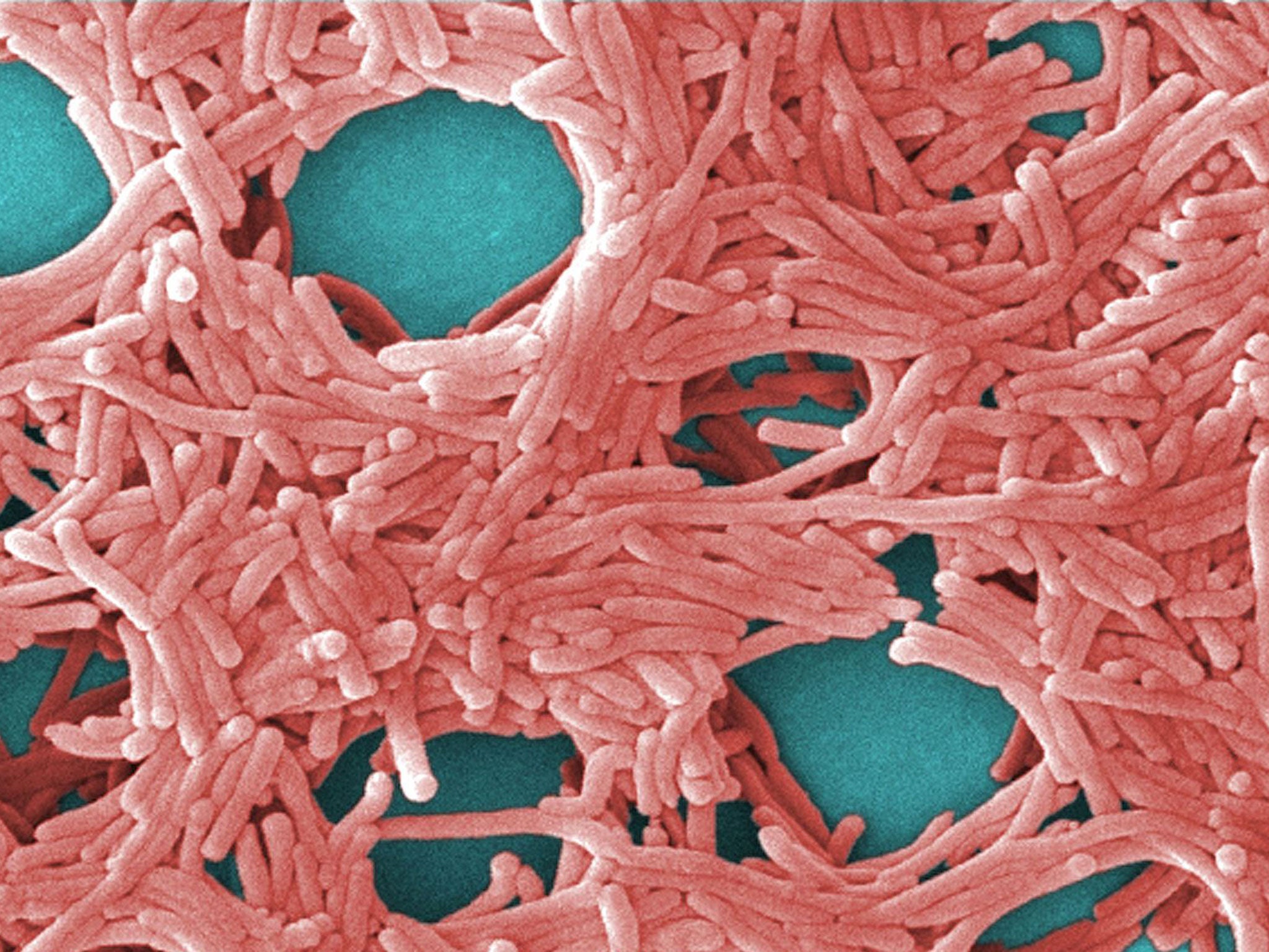 Legionella bacteria magnified by 5000 per cent (Image: Public domain)