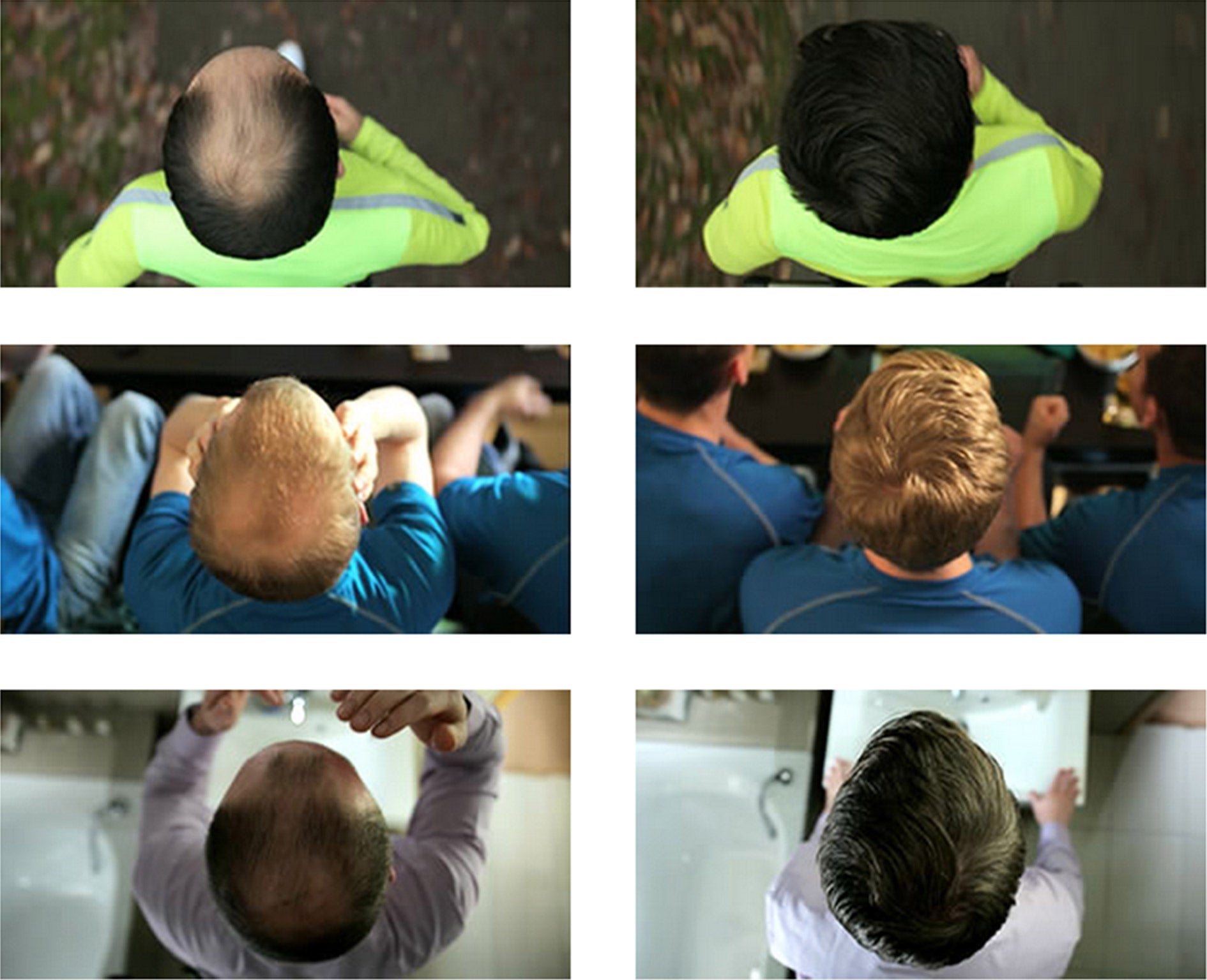 The Ziering advert; the ASA pointed out those on the right have thicker hair all over their heads