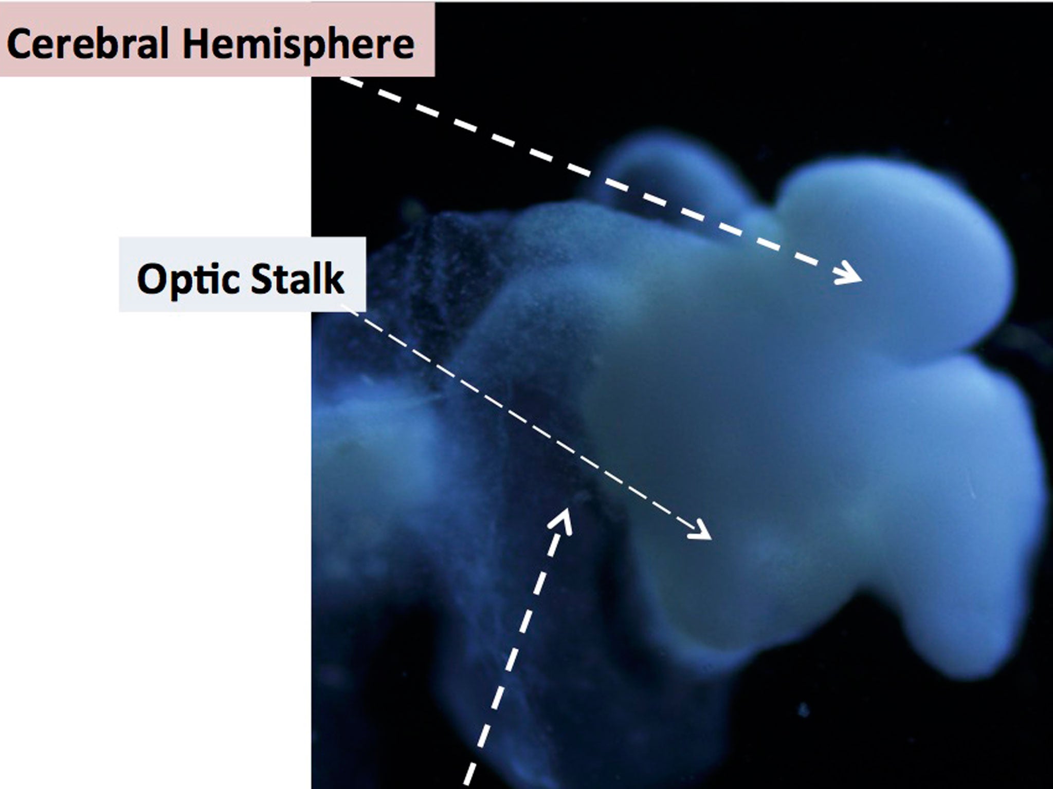 Scientists at Ohio State University say the brain is the size of a pencil eraser