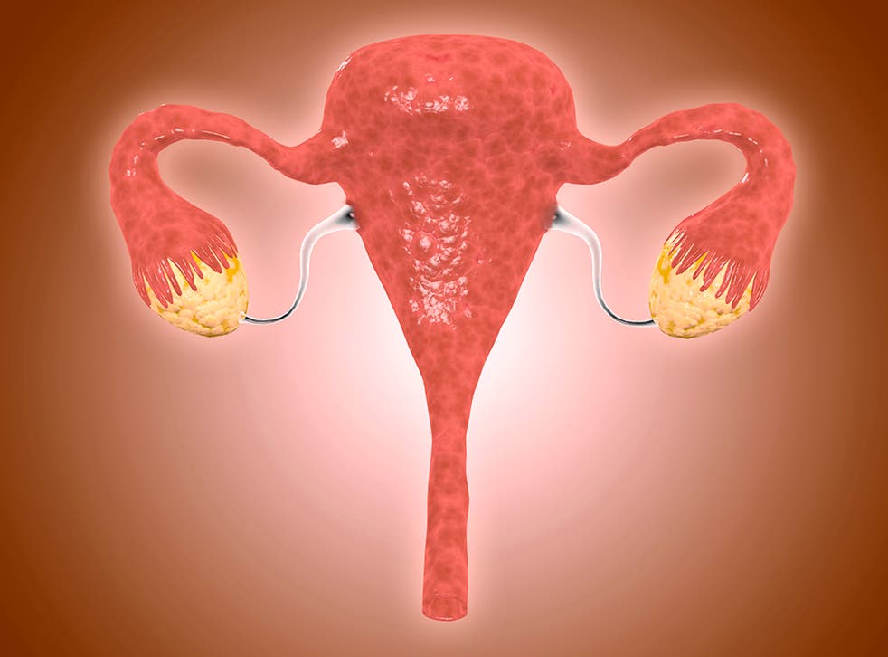PCOS: what are the symptoms of Polycystic Ovary Syndrome and how is it