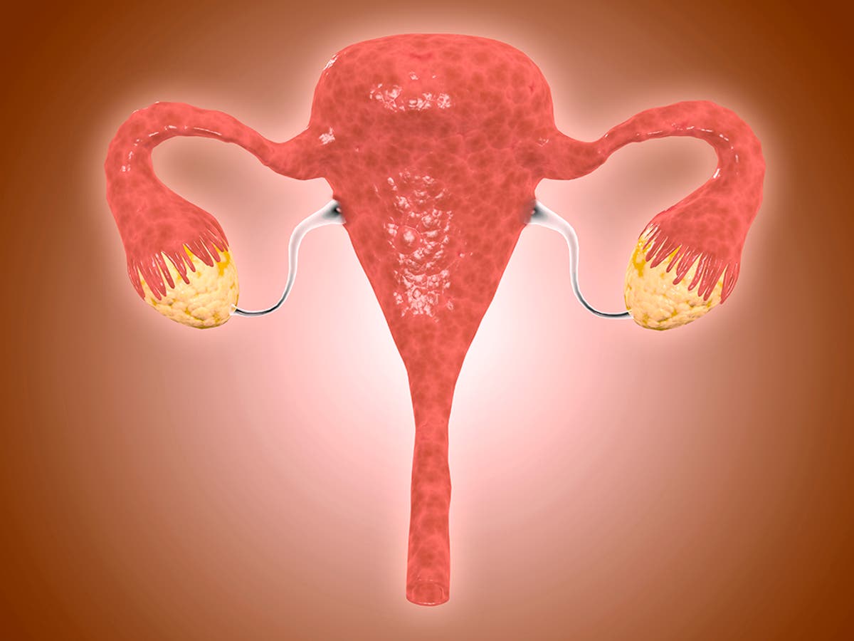 Can You Develop Polycystic Ovaries After Having A Baby?