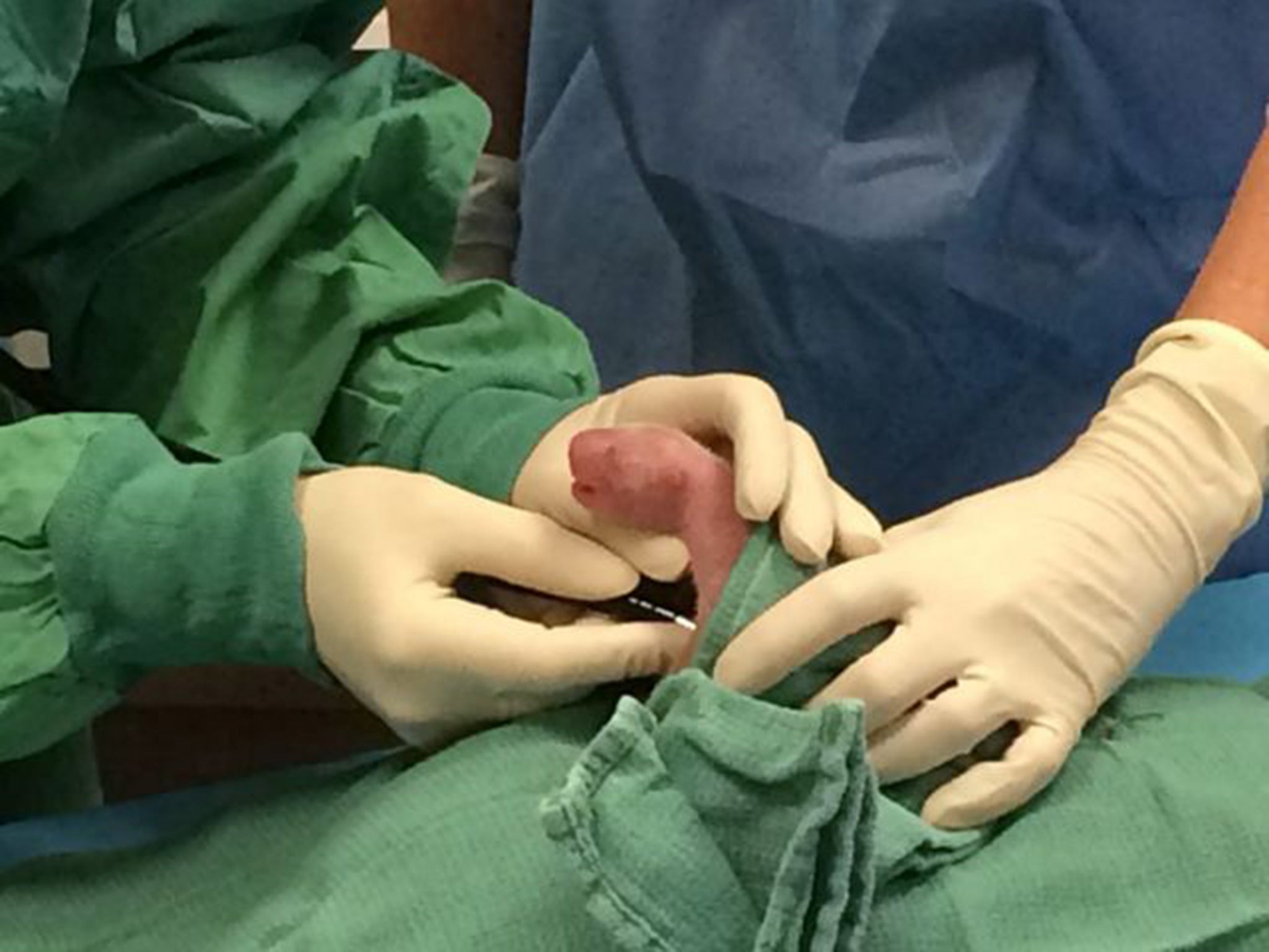 Veterinarians examining one of the two new born giant panda cubs from a litter born earlier this year in Washington