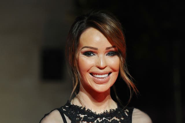 Katie Piper had to have more than 40 operations after the attack