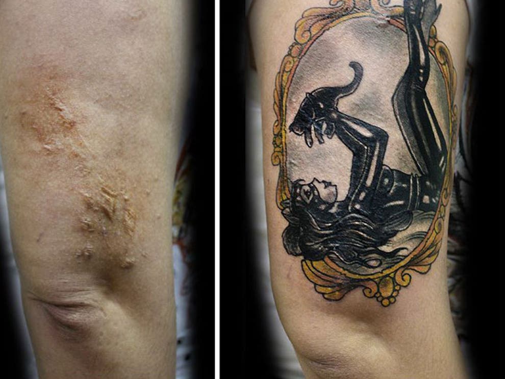 A Tattoo Artist Is Inking Over The Scars Of Victims Of Domestic Violence For Free The