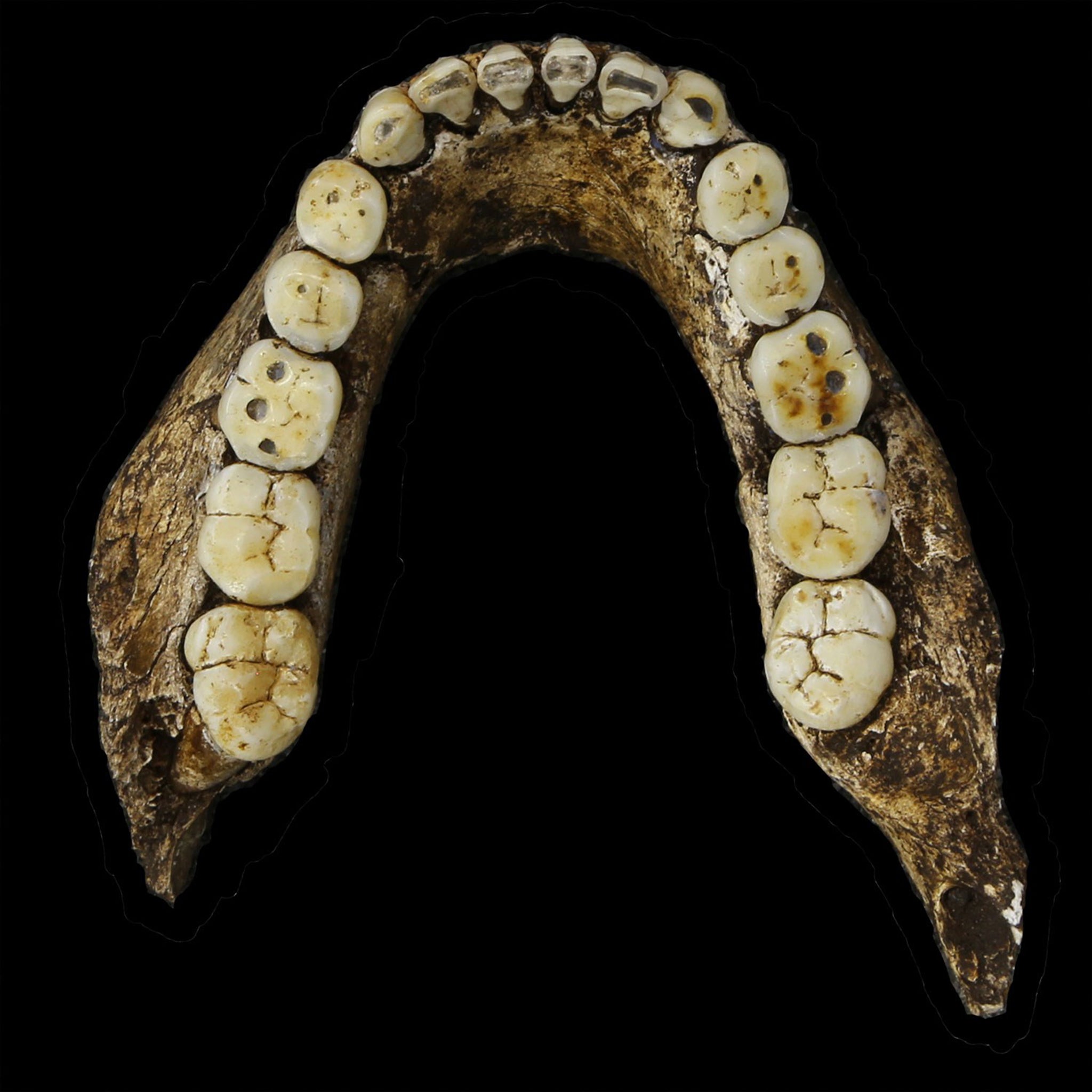 A mandible occlusal of Homo Naledi