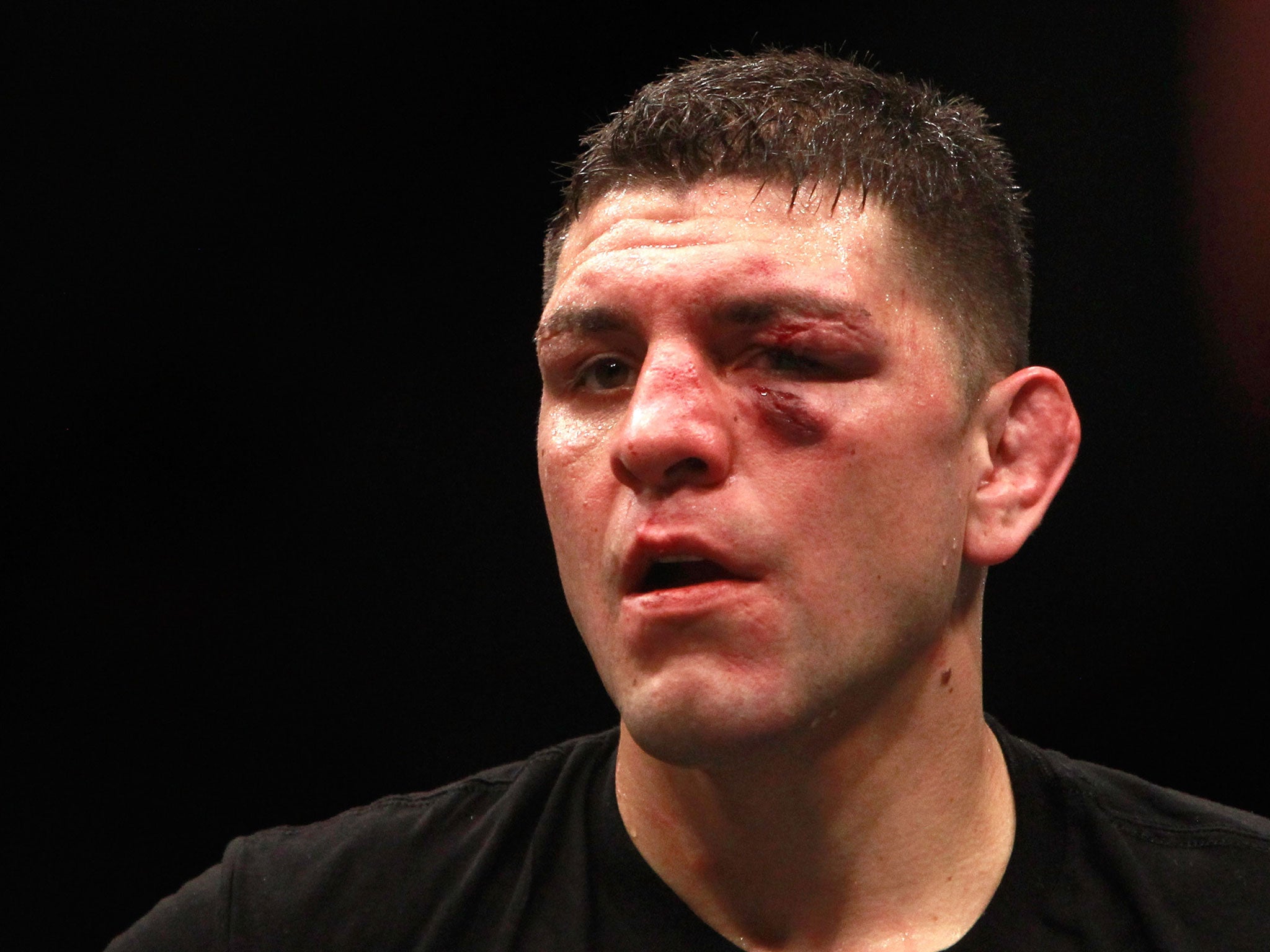 Nick Diaz has been baned from the UFC for five years
