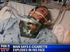Exploding e-cigarette blows hole through man's palate, fractures neck