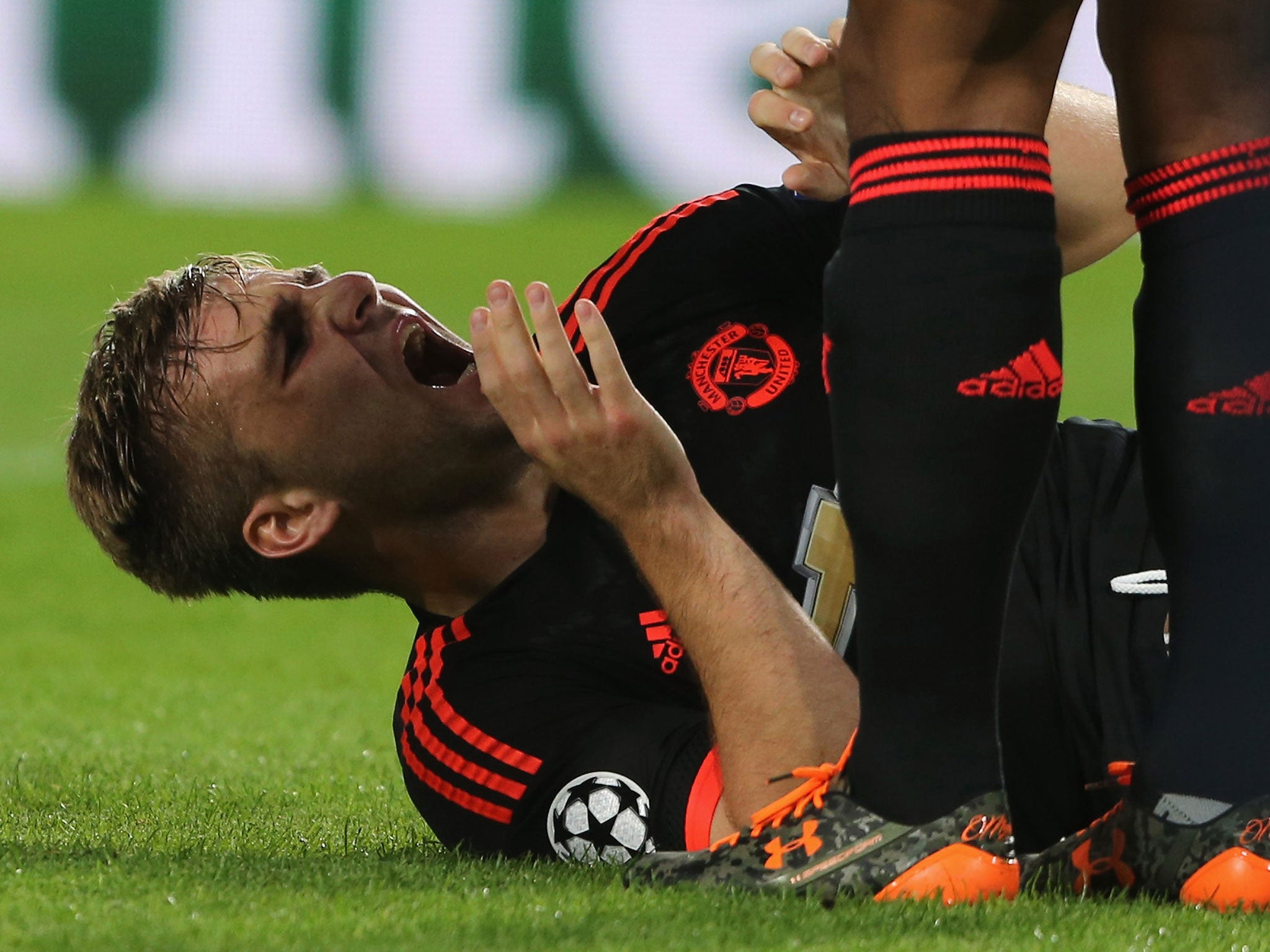 Luke Shaw has suffered a double fracture of his right leg