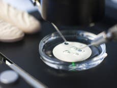 Improved IVF won’t be enough to help young women start a family