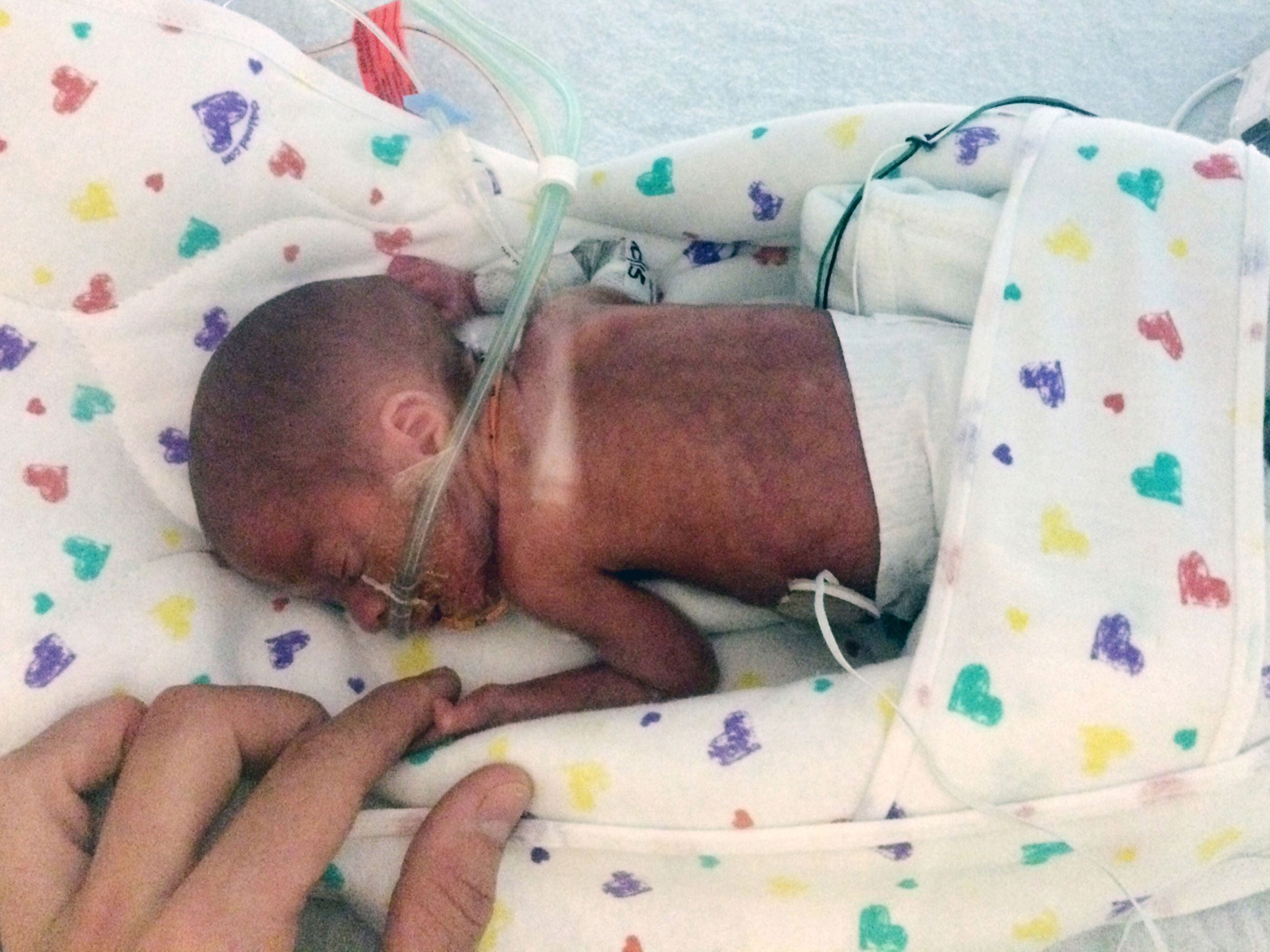 Tiny Baby Born Four Months Early On Cruise Ship Survives The Independent The Independent