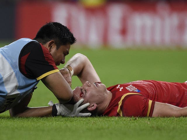 Liam Williams was forced off after being kicked in the head