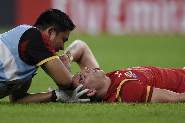 Liam Williams was forced off after being kicked in the head