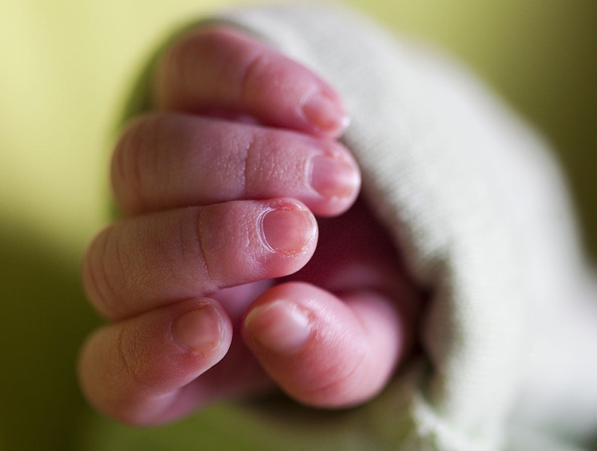 The baby had been born six weeks prematurely