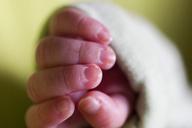 The baby had been born six weeks prematurely