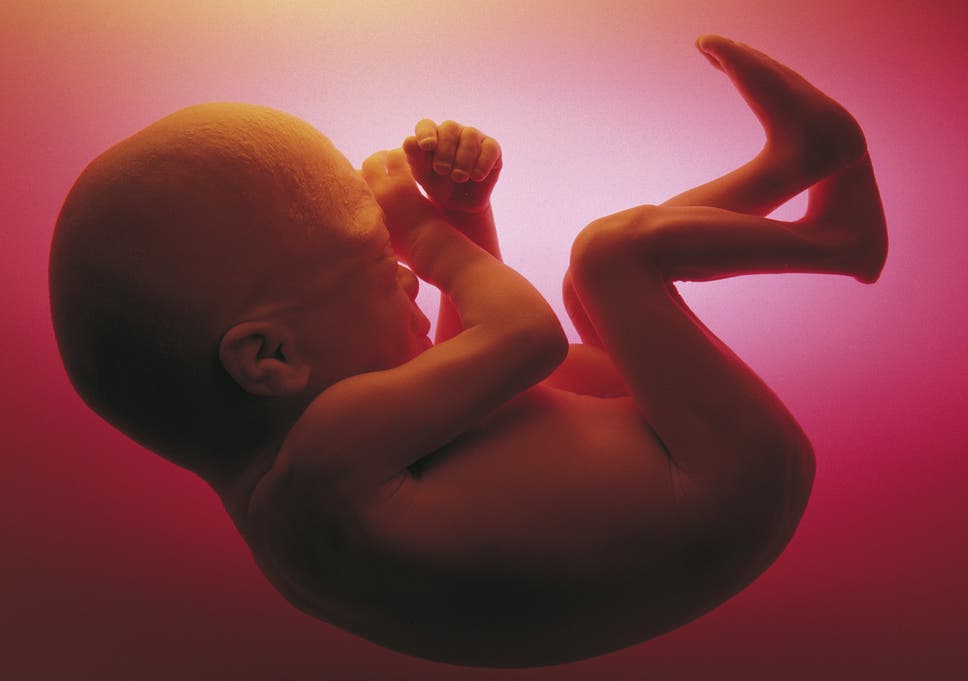 foetus in foetu