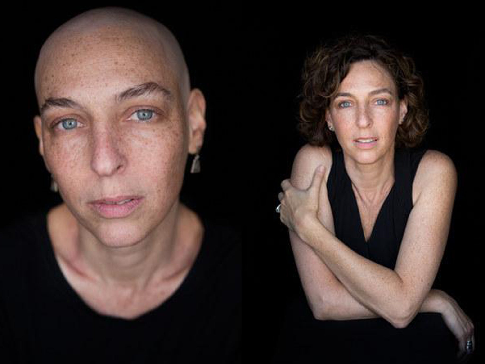 chemotherapy patient before and after