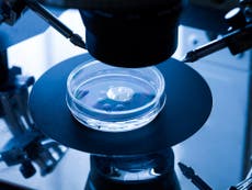 Read more

Licence to genetically modify human embryos 'could revolutionise IVF'