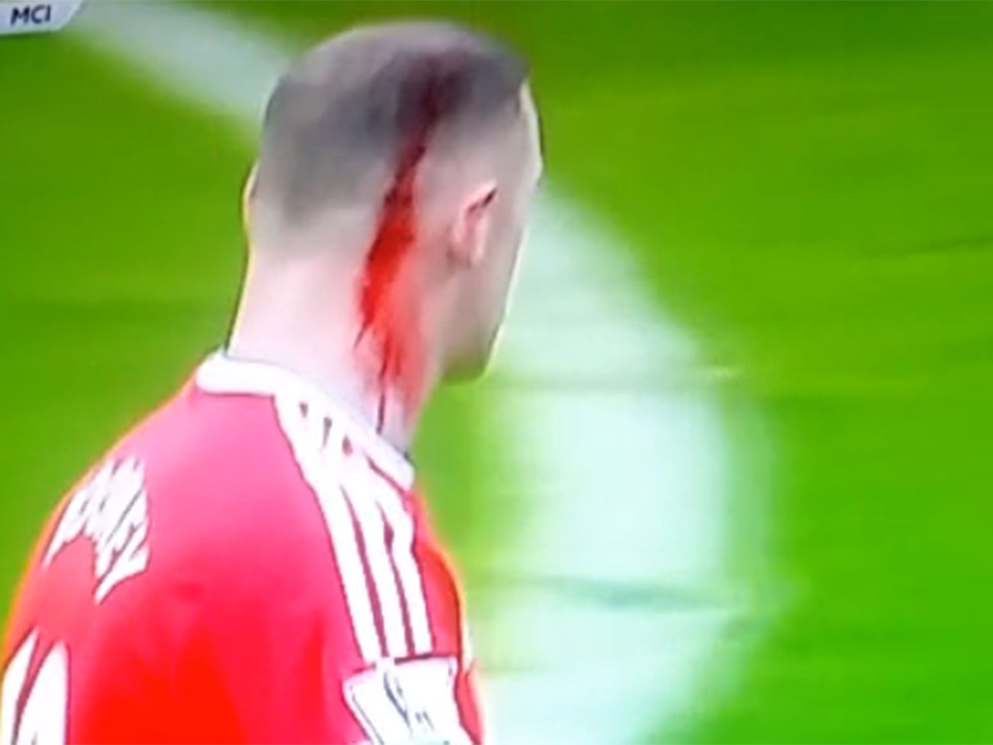 Blood streams down Rooney's head