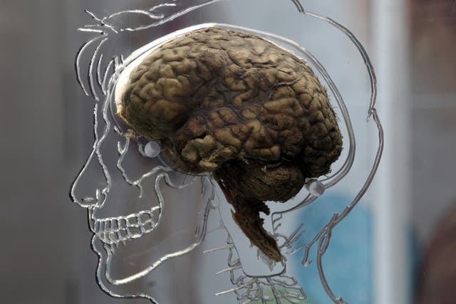 The company is developing techniques to take people's brains out and freeze them until they are ready