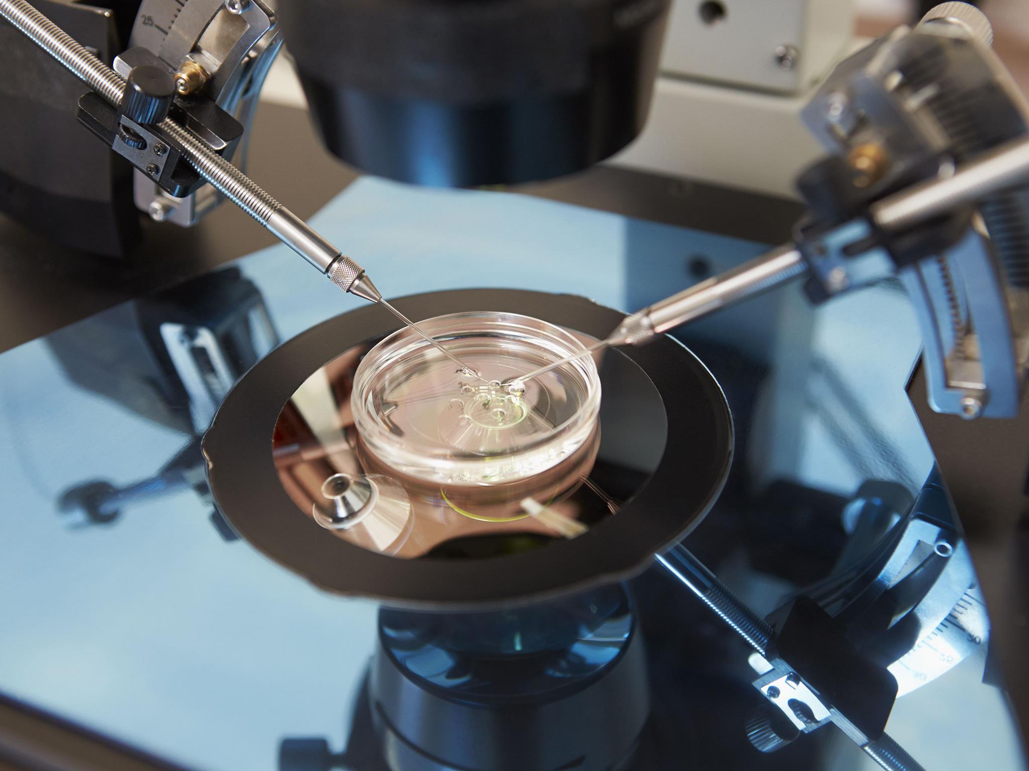 Laboratory fertilisation of eggs in IVF treatment