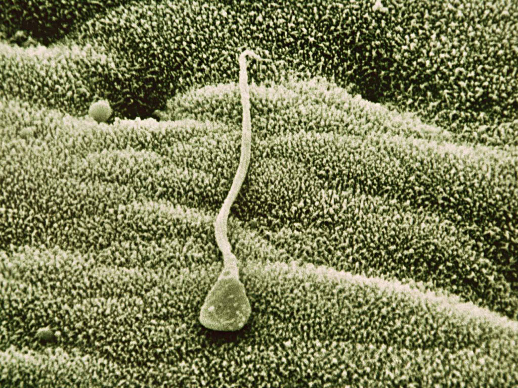 Start the clock: male sperm, shown here magnified in the uterus, declines in quantity and genetic quality after a man turns 35