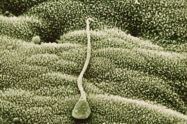 Start the clock: male sperm, shown here magnified in the uterus, declines in quantity and genetic quality after a man turns 35
