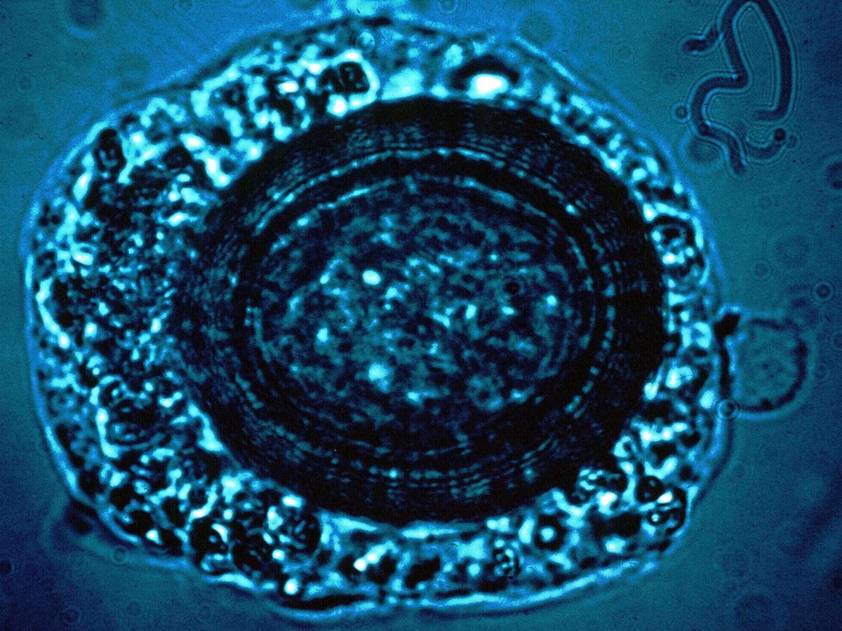 Tapeworms: Symptoms In Humans And How To Avoid Getting Infected | The  Independent | The Independent