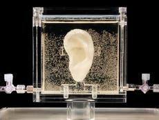 Van Gogh’ ear recreated using DNA, and it can hear you