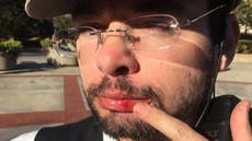 Preacher ‘punched in mouth’ for speaking about Michael Brown at Mizzou