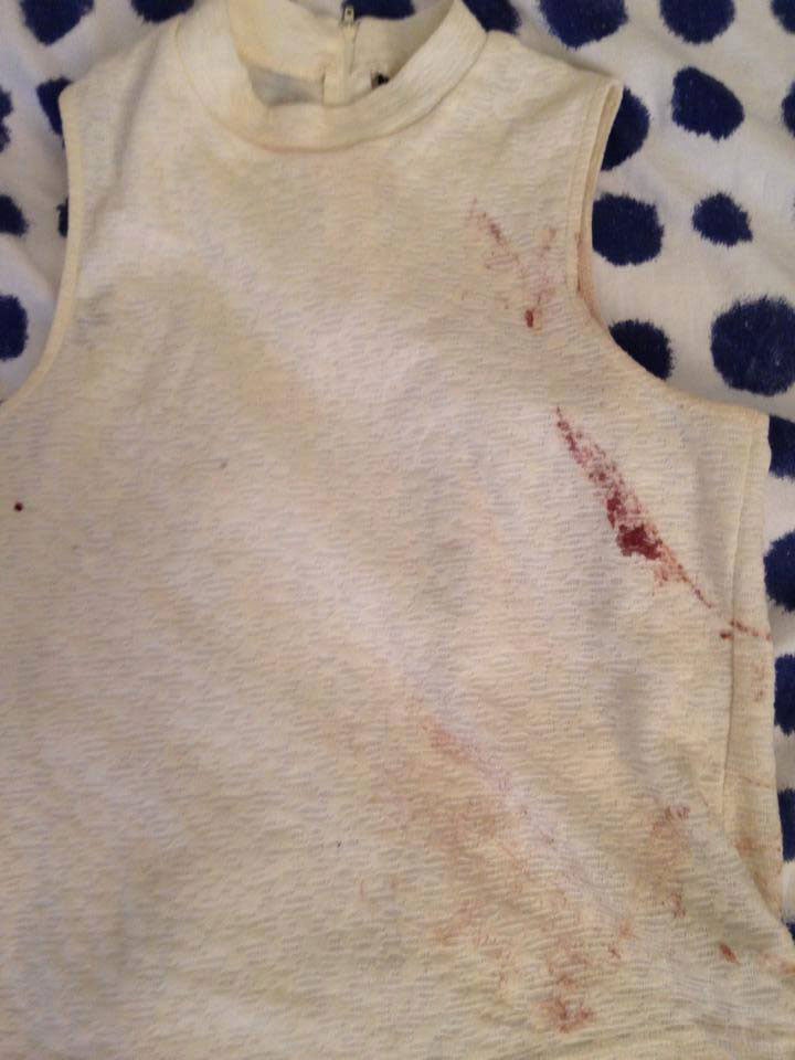 Isobel Bowdery's blood-stained T-shirt Facebook