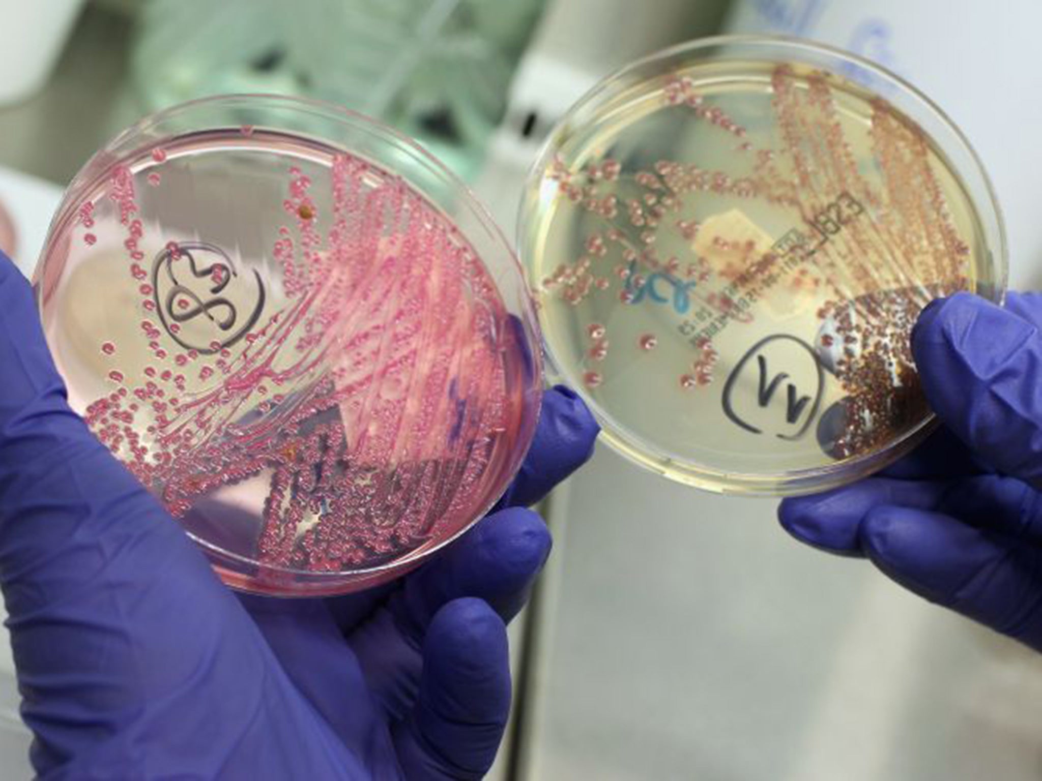The PHE labs test samples sent by various agencies, looking for E.coli (pictured), salmonella, legionella and more