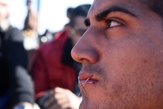 A migrant sits in no-man's land with his mouth sewn shut during a protest near the village of Idomeni at the Greek-Macedonian border, on Monday, Nov. 23, 2015.