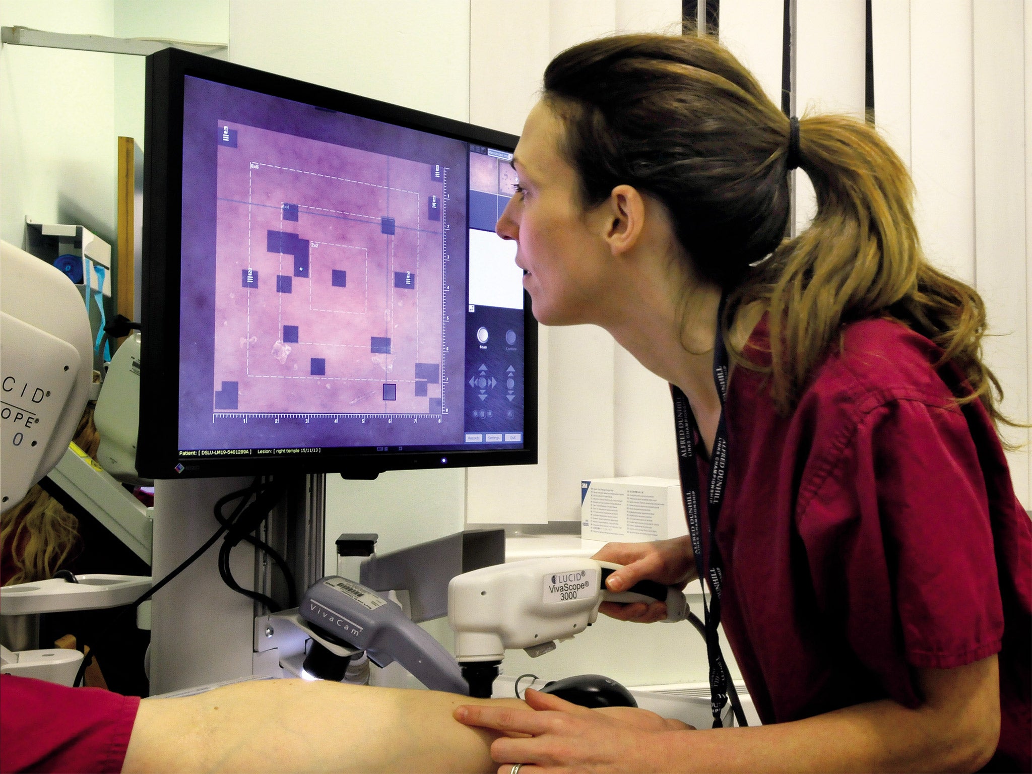 In the flesh: Dr Emma Craythorne uses a confocal microscope to do a virtual biopsy on a suspicious mole at St John’s Institute of Dermatology