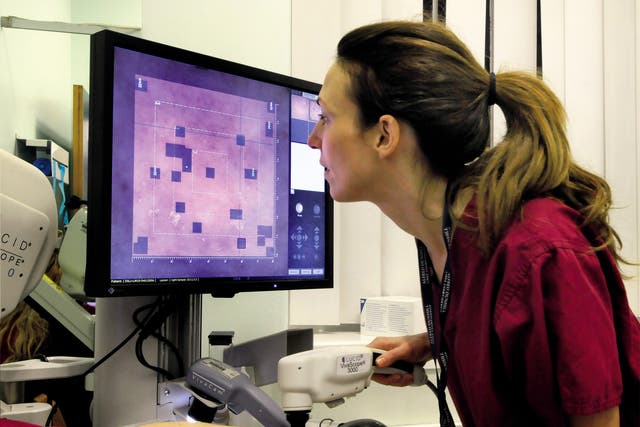 In the flesh: Dr Emma Craythorne uses a confocal microscope to do a virtual biopsy on a suspicious mole at St John’s Institute of Dermatology