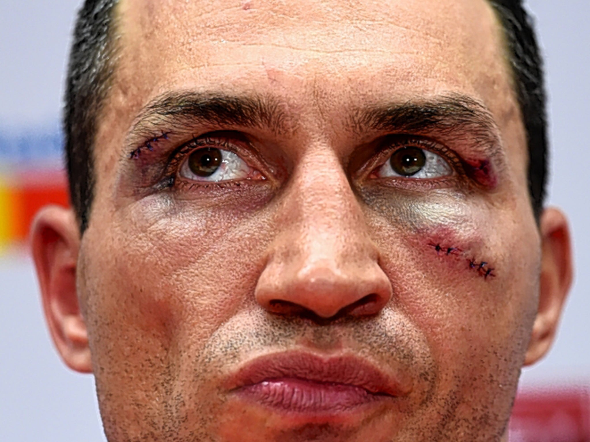 Wladimir Klitschko shows the effects of his loss by Tyson Fury in the post-fight press conference