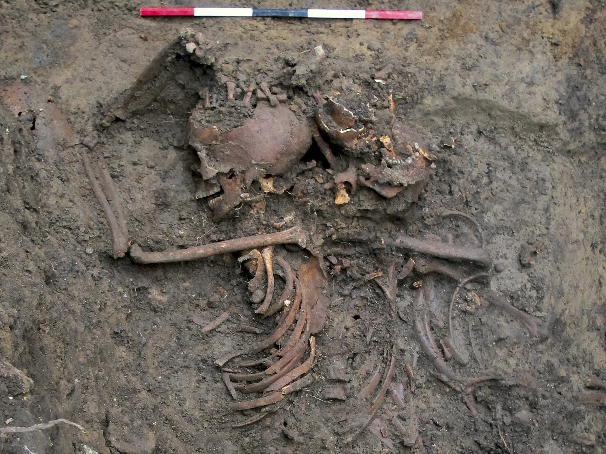 &#13;
The remains of between 17 and 28 Scottish soldiers were discovered in 2013 in two mass graves on the site of Durham Castle &#13;
