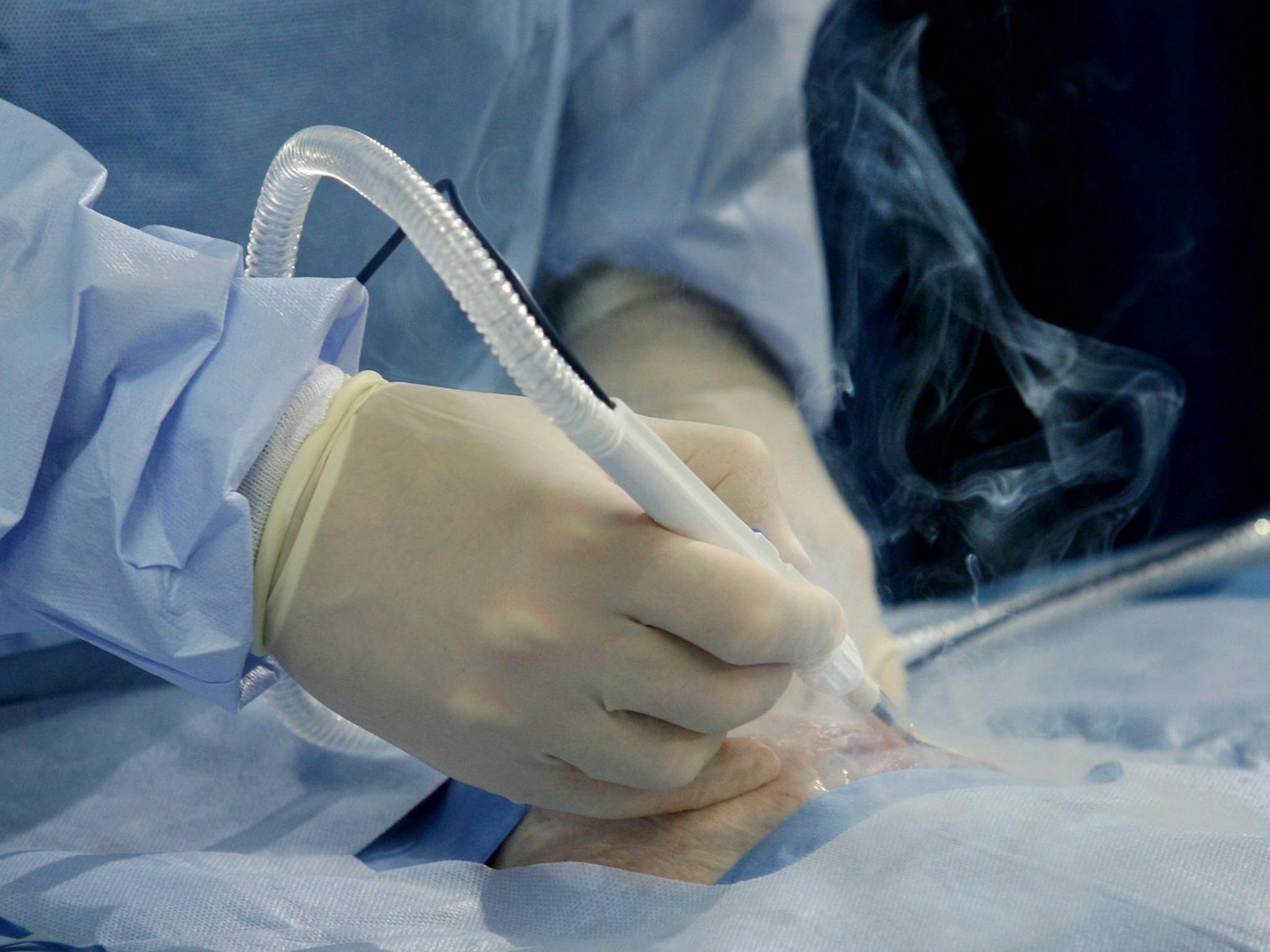 Lasers and cauterizing tools used during surgery