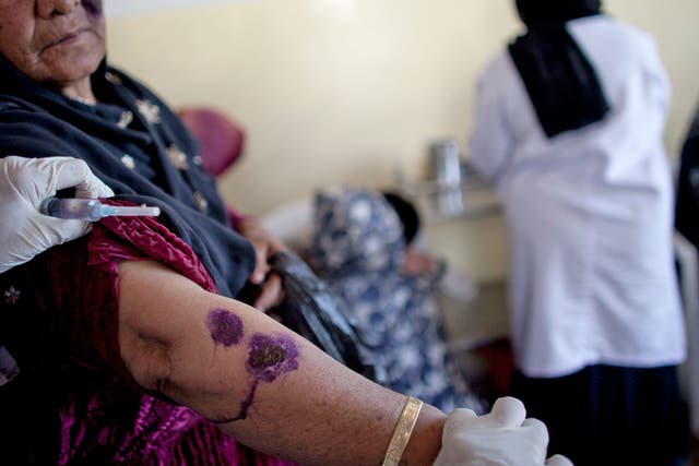 A woman shows signs of the condition on her arm